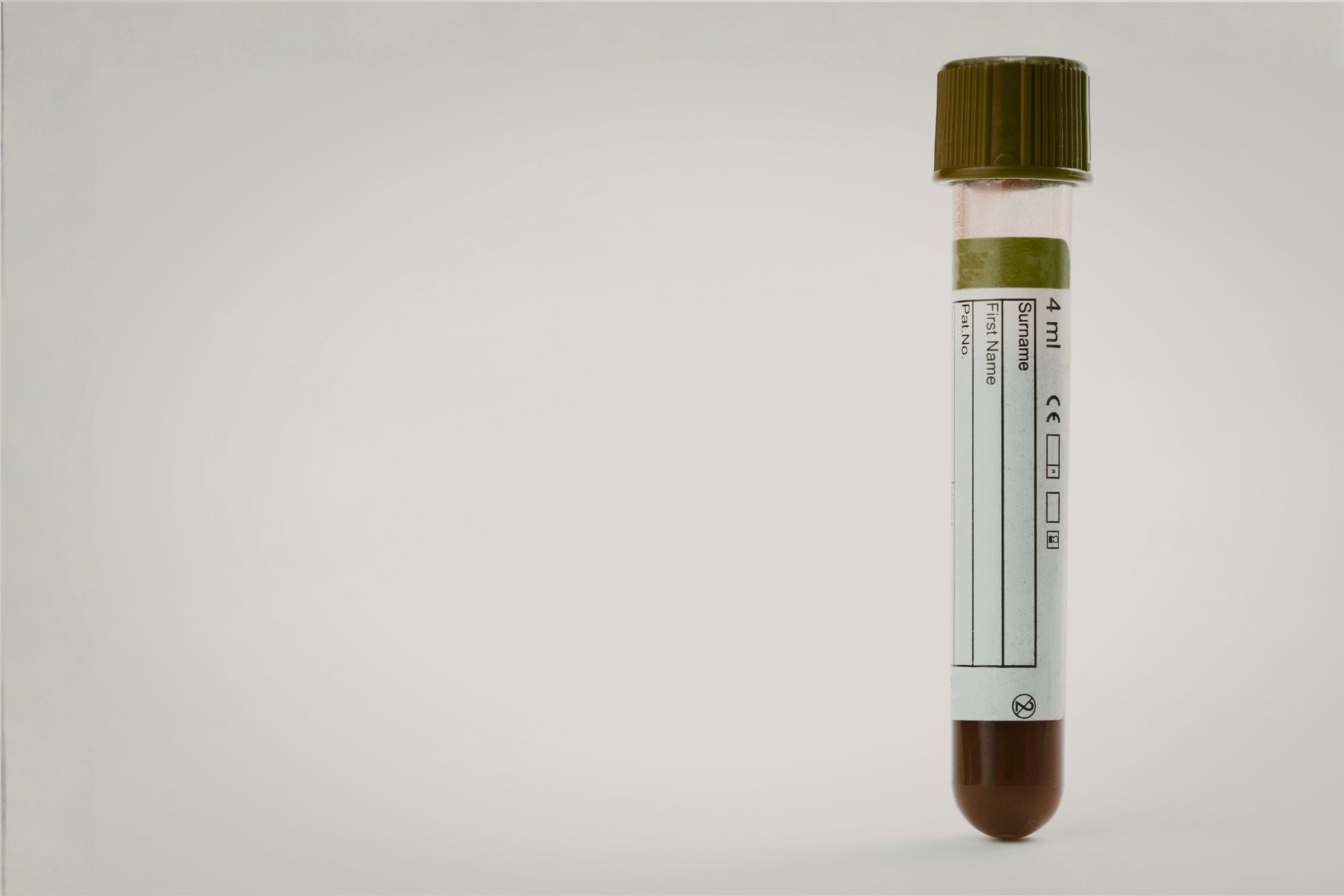 Blutprobe bearbeitet